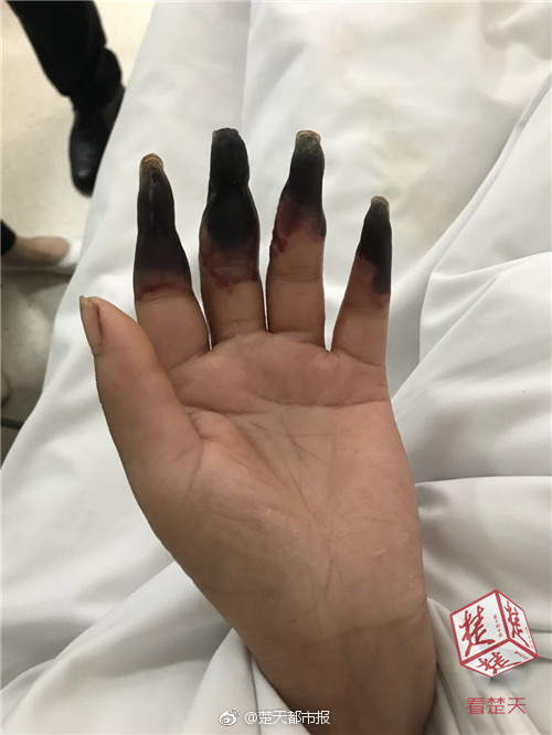 {随机关键词}